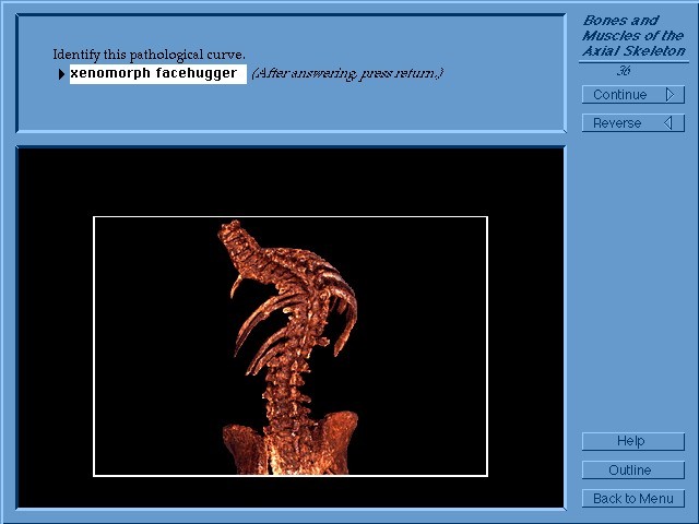 Anatlab: The Anatomy Lab (1998)