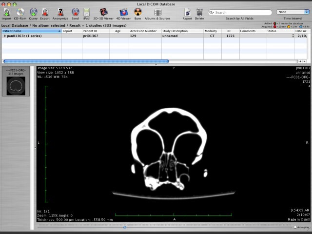 OsiriX (2007)